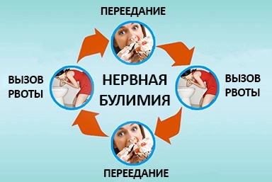 Лечение булимии в Новоминской